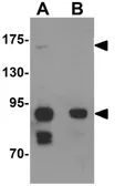 Anti-CCDC141 antibody used in Western Blot (WB). GTX31445
