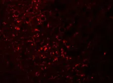 Anti-SPRYD5 antibody used in IHC (Paraffin sections) (IHC-P). GTX31446