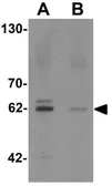 Anti-KCNK13 antibody used in Western Blot (WB). GTX31448