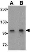 Anti-Coronin 7 antibody used in Western Blot (WB). GTX31451
