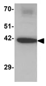 Anti-Draxin antibody used in Western Blot (WB). GTX31456