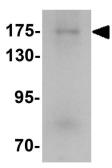 Anti-Strumpellin antibody used in Western Blot (WB). GTX31457