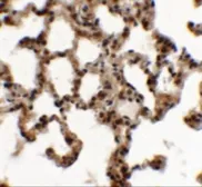 Anti-ECG2 antibody used in IHC (Paraffin sections) (IHC-P). GTX31458