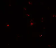 Anti-TGM7 antibody used in Immunocytochemistry/ Immunofluorescence (ICC/IF). GTX31460
