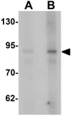 Anti-AFAP antibody used in Western Blot (WB). GTX31462