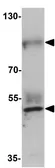 Anti-Prickle2 antibody used in Western Blot (WB). GTX31463