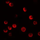 Anti-CASKIN2 antibody used in Immunocytochemistry/ Immunofluorescence (ICC/IF). GTX31467