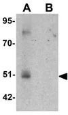 Anti-FOXD4L1 antibody used in Western Blot (WB). GTX31468