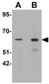 Anti-GRB10 antibody used in Western Blot (WB). GTX31469