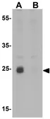 Anti-NKX2.8 antibody used in Western Blot (WB). GTX31471