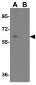 Anti-NCLN antibody used in Western Blot (WB). GTX31476