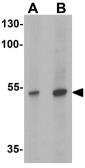 Anti-LBP9 antibody used in Western Blot (WB). GTX31477
