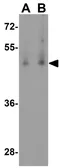 Anti-BMP15 antibody used in Western Blot (WB). GTX31485