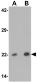 Anti-PHOX2B antibody used in Western Blot (WB). GTX31486