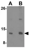 Anti-C6ORF173 antibody used in Western Blot (WB). GTX31488