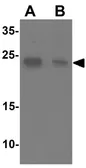 Anti-TCTEX1D2 antibody used in Western Blot (WB). GTX31489