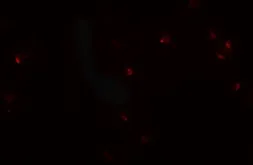 Anti-CRIM1 antibody used in Immunocytochemistry/ Immunofluorescence (ICC/IF). GTX31490