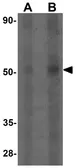 Anti-ATG14 antibody used in Western Blot (WB). GTX31498