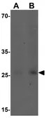 Anti-VNN3 antibody used in Western Blot (WB). GTX31500