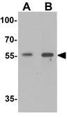 Anti-GHDC antibody used in Western Blot (WB). GTX31501