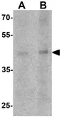 Anti-LMX1A antibody used in Western Blot (WB). GTX31507
