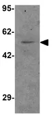 Anti-Pannexin 1 antibody used in Western Blot (WB). GTX31510