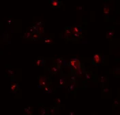 Anti-Cripto antibody used in Immunocytochemistry/ Immunofluorescence (ICC/IF). GTX31511