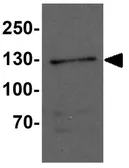 Anti-FMNL1 antibody used in Western Blot (WB). GTX31512