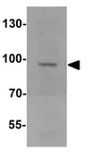 Anti-JAKMIP2 antibody used in Western Blot (WB). GTX31514