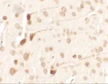 Anti-TCTP antibody used in IHC (Paraffin sections) (IHC-P). GTX31519