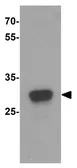Anti-IL15 Receptor alpha antibody used in Western Blot (WB). GTX31523