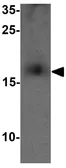Anti-CD59 antibody used in Western Blot (WB). GTX31524