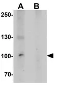 Anti-KANK2 antibody used in Western Blot (WB). GTX31536