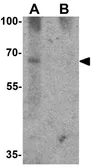 Anti-GBP5 antibody used in Western Blot (WB). GTX31537
