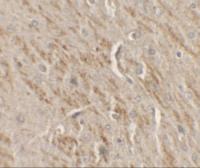 Anti-TIP60 antibody used in IHC (Paraffin sections) (IHC-P). GTX31538