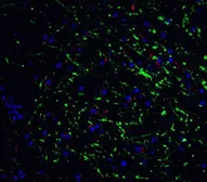 Anti-GABARAP antibody used in IHC (Paraffin sections) (IHC-P). GTX31541