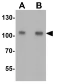 Anti-TIF1 alpha antibody used in Western Blot (WB). GTX31544