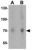 Anti-TIF1 gamma antibody used in Western Blot (WB). GTX31545
