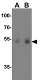 Anti-DOPA Decarboxylase antibody used in Western Blot (WB). GTX31550