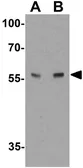 Anti-ARSB antibody used in Western Blot (WB). GTX31552
