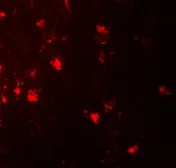 Anti-IL1F6 antibody used in IHC (Paraffin sections) (IHC-P). GTX31555
