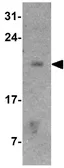 Anti-COMMD7 antibody used in Western Blot (WB). GTX31559
