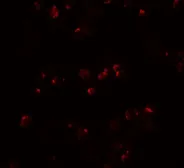 Anti-IL22 antibody used in Immunocytochemistry/ Immunofluorescence (ICC/IF). GTX31563