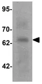 Anti-GRK6 antibody used in Western Blot (WB). GTX31564