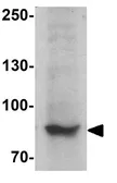 Anti-SMURF2 antibody used in Western Blot (WB). GTX31571
