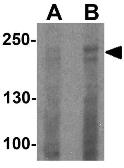 Anti-DOCK8 antibody used in Western Blot (WB). GTX31578
