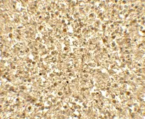 Anti-SREBP1 antibody used in IHC (Paraffin sections) (IHC-P). GTX31579
