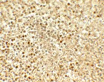 Anti-SREBP2 antibody used in IHC (Paraffin sections) (IHC-P). GTX31580