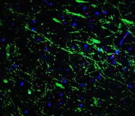 Anti-PINK1 antibody used in IHC (Paraffin sections) (IHC-P). GTX31581
