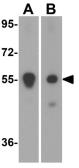 Anti-PINK1 antibody used in Western Blot (WB). GTX31581